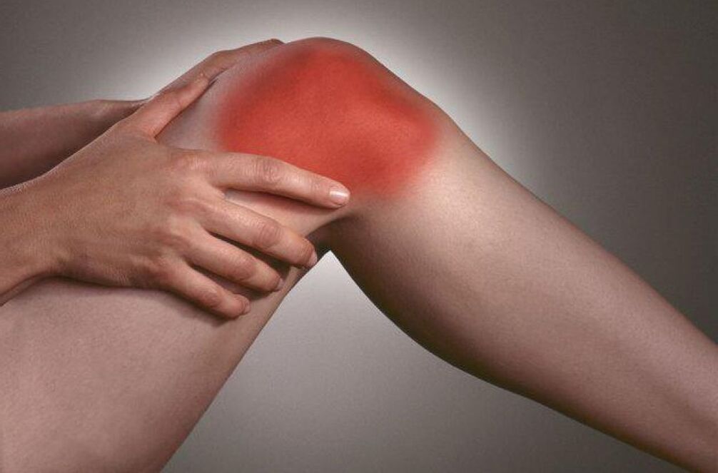 arthropathy knee pain