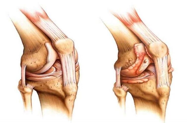 healthy knee and knee joint joints