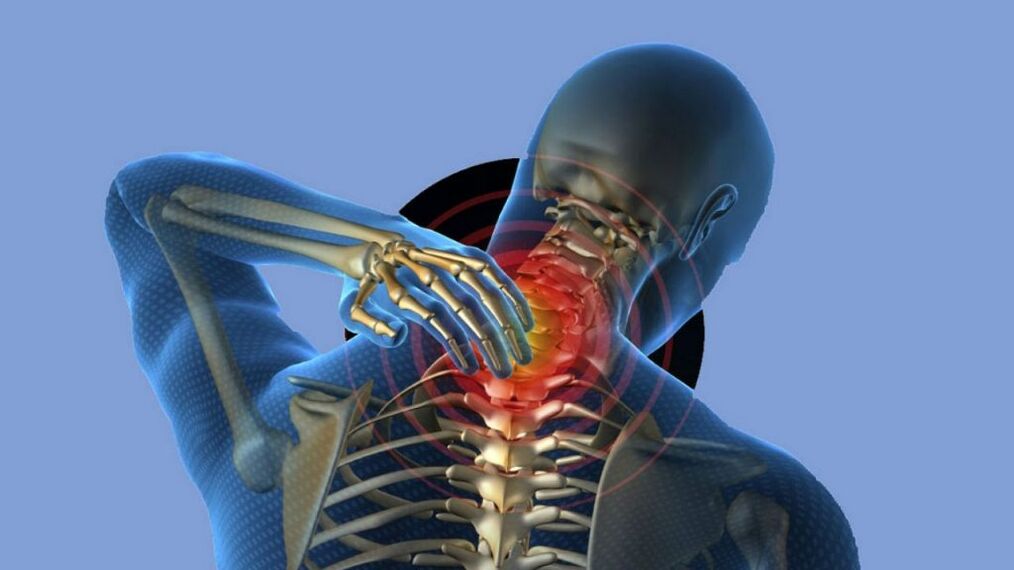 Cervical area osteochondria