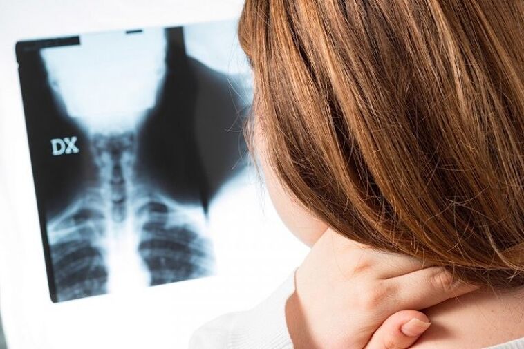 X -ray of cervical area