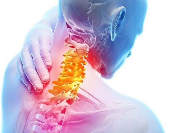 Cervical spine osteochondria